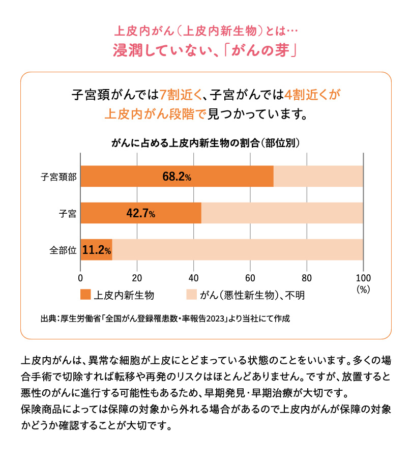 上皮内がん（上皮内新生物）とは…浸潤していない、「がんの芽」子宮頚がんでは７割近く、子宮がんでは４割近くが上皮内がん段階で見つかっています。