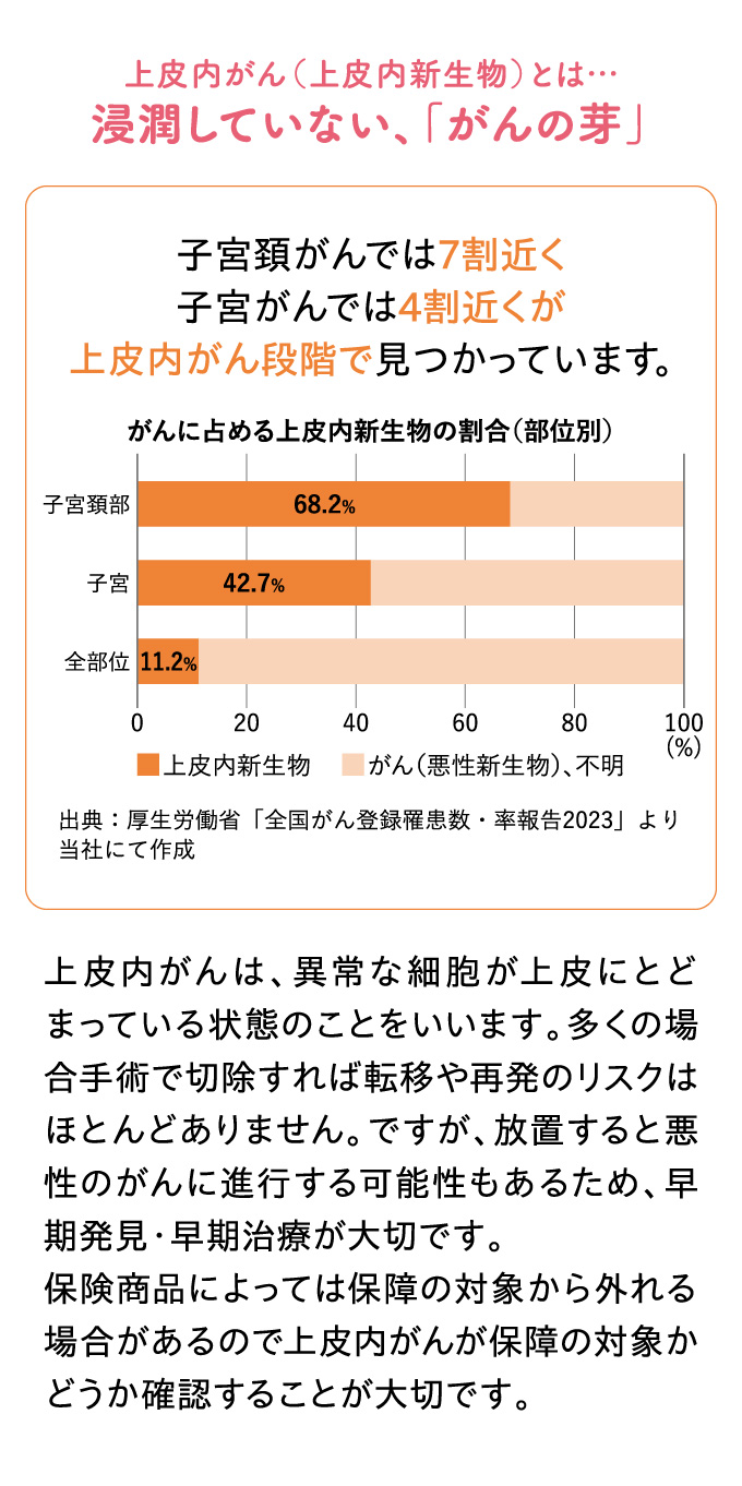 上皮内がん（上皮内新生物）とは…浸潤していない、「がんの芽」子宮頚がんでは７割近く、子宮がんでは４割近くが上皮内がん段階で見つかっています。