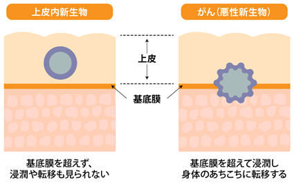 医師の診察を受ける患者